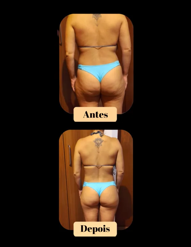 Transformação de aluna, antes e depois